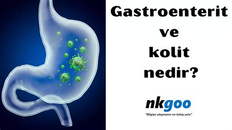 gastroenterit ve kolit diğer tanımlanmış enfektif olmayan nedir
